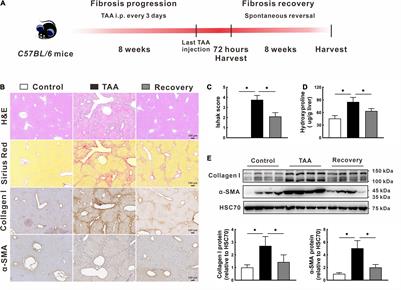 Integrated Analysis of Hepatic miRNA and mRNA Expression Profiles in the Spontaneous Reversal Process of Liver Fibrosis